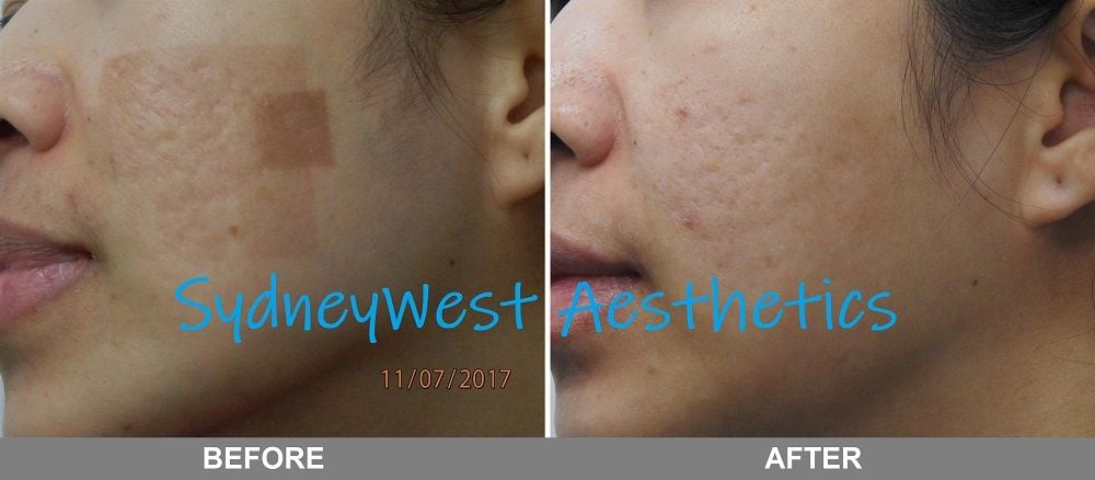 Pigmentation Image -5c6eabeb141db